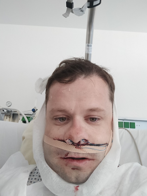 After the operation