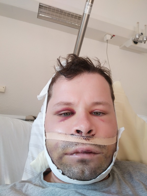 Day 4 nach der Operation